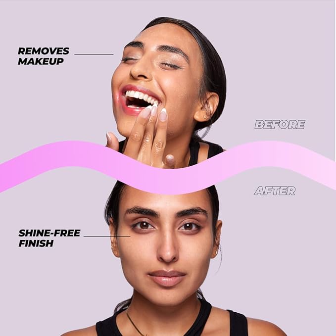 Vitamasques Oil to Milk Cleanser Face Wash & Makeup Remover – Korean Cleansing Oil for Face, Deep Pore Clean, Gentle Facial Oil Cleanser, Quick Rinse-Off & No Oily Residue (4.05 Fl Oz)