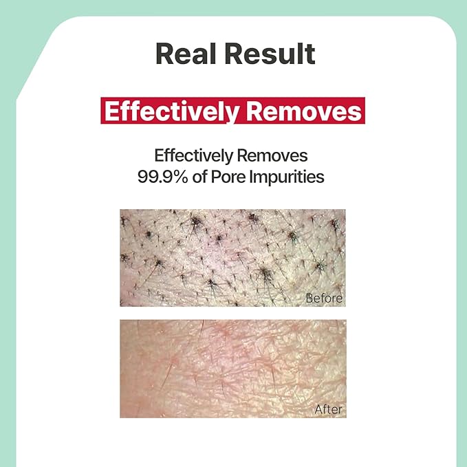 Illiyoon Gentle Deep Facial Cleanser | Low pH Gel-to-Foam Face Wash for Sensitive Skin, Hydrating Gel Cleanser & Daily Makeup Remover, Korean Skincare, 8.45 fl.oz.