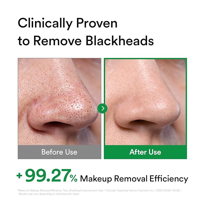 Hydrating Light Cleansing Oil for Sensitive Skin, Waterproof Makeup Remover & Blackhead Cleaner with Rice Bran Oil, Turmeric, and Centella Asiatica, Korean Skin care (205ml/6.93 fl oz)