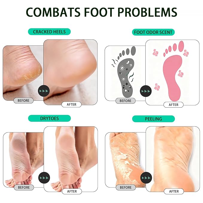 Tea Tree Oil Epsom Salt Foot Soak Foot spa Odor Scent,Dry Foot,Callus,500g | Cleansing,Soothing,Organic Natural ingredient for improved irritated,Dry Cracked, Tired Feet, Stubborn Foot Odor Elimination